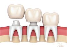 Без названия.png